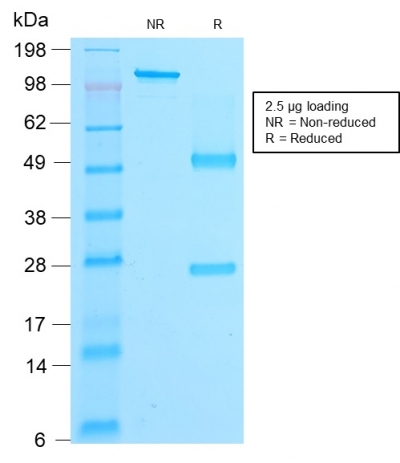 Data from SDS-PAGE analysis of Anti-beta-Catenin antibody (Clone rCTNNB1/2173). Reducing lane (R) shows heavy and light chain fragments. NR lane shows intact antibody with expected MW of approximately 150 kDa. The data are consistent with a high purity, intact mAb.